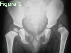 Figura 1