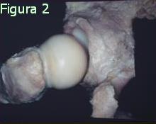 Figura 2