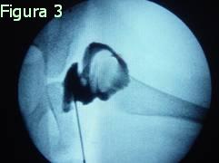 Figura 3