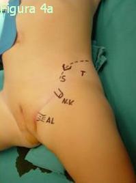 Figura 4a