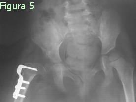 Figura 5