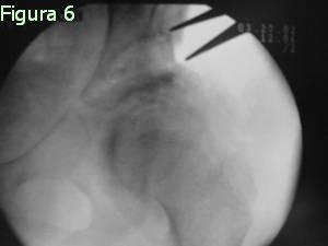 Figura 6